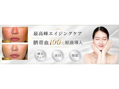 ソアン(Soin)の写真