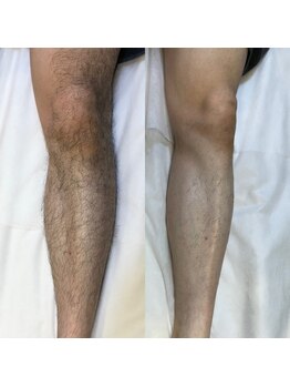 メンズプシュケ(men's PSYCHE)/