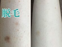 レディース ビホウ(BIHOU)/