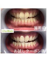 ルブラン 奈良店(Le Blanc)/お酒やカレー好きな女子！！