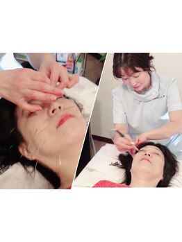 小顔になりたい