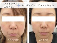 カスミ板橋ベルミーランドの雰囲気（しみ/しわ/たるみ 肌質を変化させるエイジングケア）