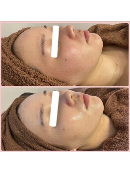 メリー 大和八木店(merry)/赤みを抑えてトーンアップ♪