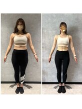 ノンバーバル みなとみらい店(NONVARBAL)/ 20代　before after