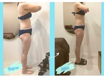 千歳の女神 岡崎店/【施術風景】Before/After