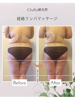 チュラ鍼灸院 西宮北口(ChuRa鍼灸院)/体重・年齢制限なし