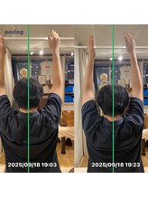 グレフル鍼灸接骨院 整体院 心斎橋/整体/肩こり/マッサージ/腰痛