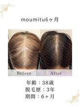 すこやか鍼灸整体院/6ヶ月でこんなに変化が！