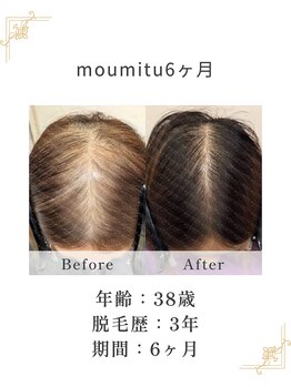 すこやか鍼灸整体院/6ヶ月でこんなに変化が！