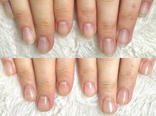 深爪矯正 爪悩み専門店 グラシナ 西宮北口店【4/3 NEW OPEN（予定）】/