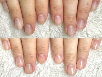 深爪矯正 爪悩み専門店 グラシナ 西宮北口店【4/3 NEW OPEN（予定）】/