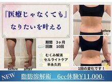 クリニカルエステ イーズ イオンモール筑紫野店の雰囲気（脂肪分解で凸凹脂肪＆むくみ改善　肌の通夜も変化します）