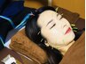 【美容鍼】むくみ・目元のシワ・たるみケア！肌質改善も♪ 40分