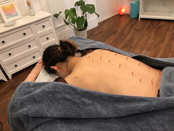 アオアクア鍼灸院(AOAQUA鍼灸院)