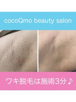 ココキューモオオズ(cocoQmo ozu)/ビフォーアフター