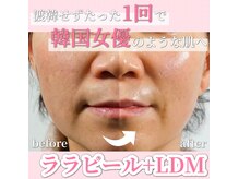 サロン(SALON)/ララピール+LDM