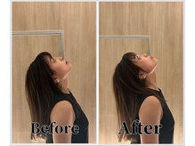 整体ラルース 中目黒(LALUZ)/20代 女性 ストレートネック改善
