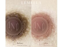 【韓国最新メラニンケア】乳頭、唇、デリケートゾーンが劇的変化