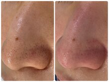 サイセイ(SAISEI)/