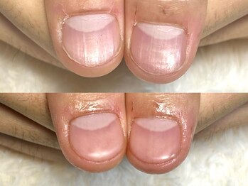 グラシナ 鳥丸店/(深爪/長さだし/フィルイン/)