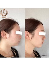 ビューティーラベンダー/Dr.Visea　痩身