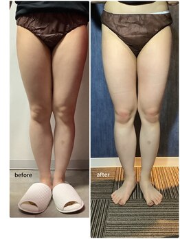 カナウ(kanau)/トリプルボディシェイプ