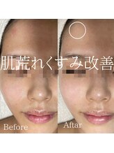 サロンディア(SALON Dea)/施術効果