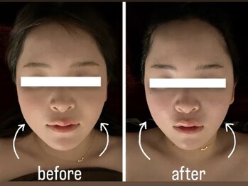 優癒/頭脳美クレンズ小顔調整