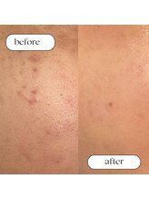 トータルビューティーサロンリア(Li'a)/ビフォー＆アフター