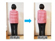銀座スッキリ整体サロン/整体でもっさり背中がスッキリ！