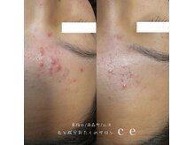 シャルム エスボーテ(charme Esbeaute)の雰囲気（肌質改善お任せ下さい♪ 細胞学に基づいたサイエンスケア）