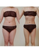 リ オアシス(Re:Oasis)/卓越ハンドでセル脂肪を撃退