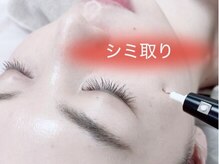エンボーテ(enbeaute)