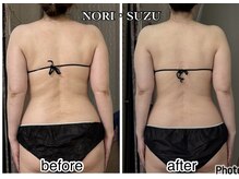 ノリスズ(NORI SUZU)/痩身◎当サロンのモンテセラピー