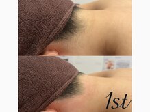 ファースト(1st)/