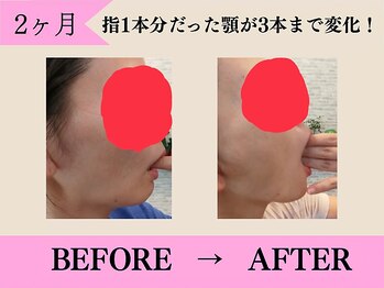 やさしい整体院 福山駅前店/顎が開きました!