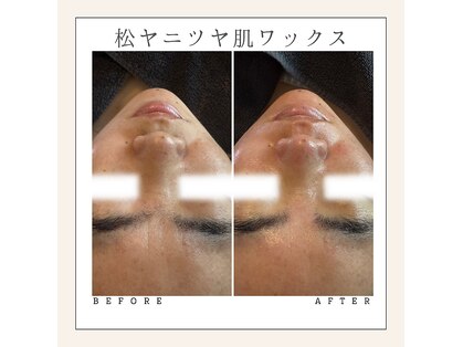 アンベリール(Embellir)の写真