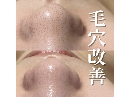 ミラーヴ(MERAVE)の写真