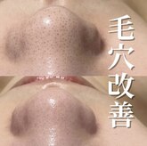 ミラーヴ(MERAVE)