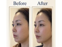 メルティーズ 東京 麻布十番(MELTY's)/