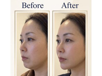 メルティーズ 東京 麻布十番(MELTY's)/