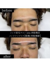 ユー 西船橋店(you)/ビフォーアフター写真