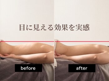 ルナリア(Lunaria)/1回の施術で変化を実感できます