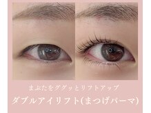 ノンチェ(Nonche)/一重奥二重《ダブルアイリフト》