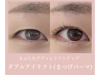 ノンチェ(Nonche)/一重奥二重《ダブルアイリフト》