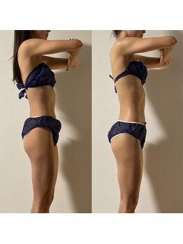 ベリッシマ筋膜セラピー/もっとメリハリボディへ