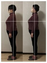 トリデ 合志店(TORIDE)/整体コースお客様の姿勢変化1