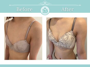 美人バスト 浜松店/◇ バストアップ &nbsp;BeforeAfter◇