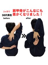 ライフタイムビューティー 梅田中崎町店(Life Time Beauty)/30代男性　首肩こりからの脱却！