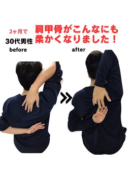 ライフタイムビューティー 梅田中崎町店(Life Time Beauty)/30代男性 首肩こりからの脱却!